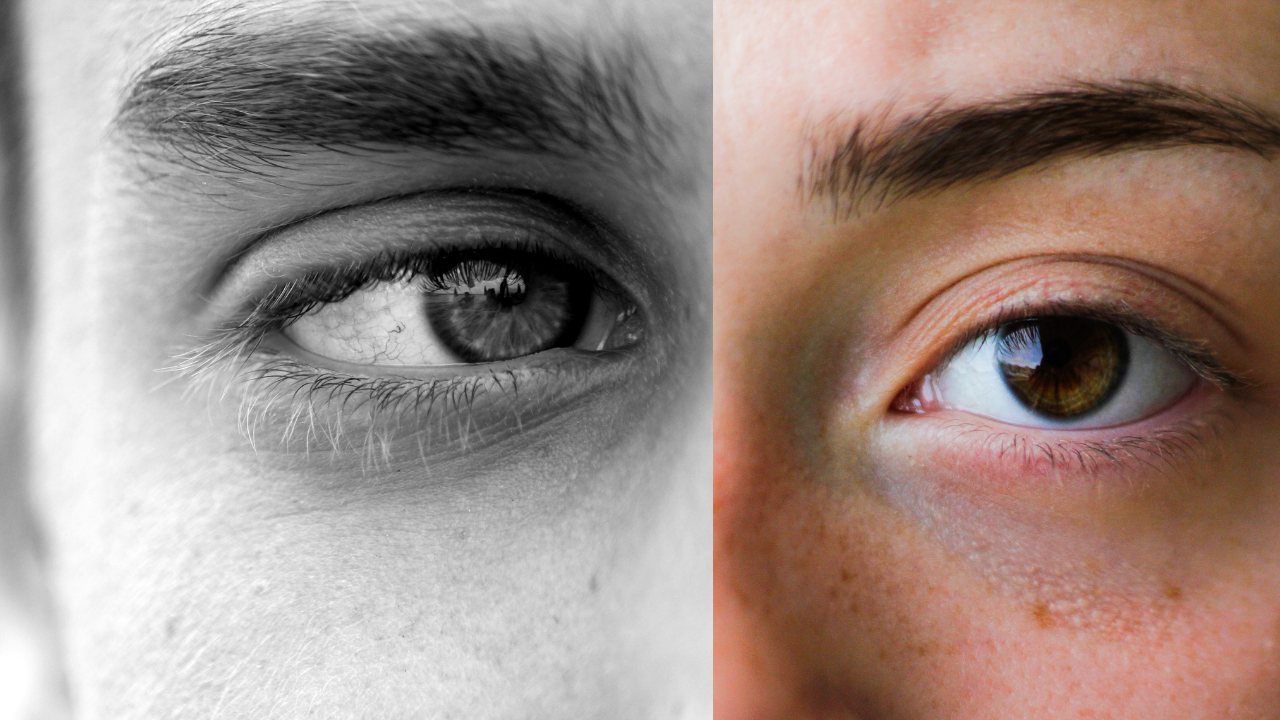 Reasons for Itchy Eyes Causes and Remedies MyMedicalBank