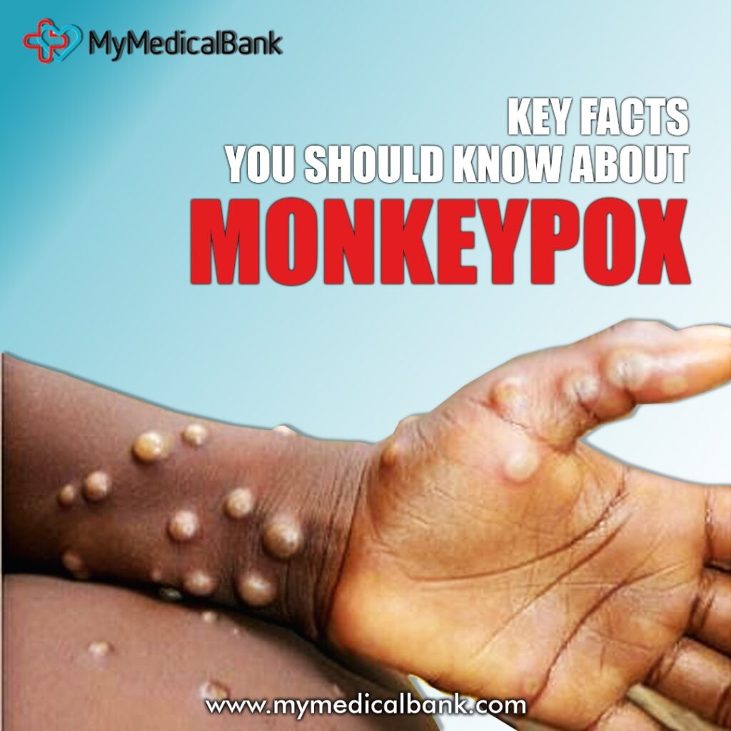 monkey-pox